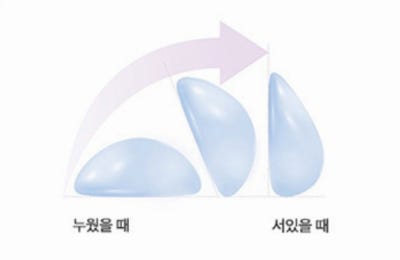 강남모티바가슴성형 후기, 현직 의사의 솔직한 의견 사진 3