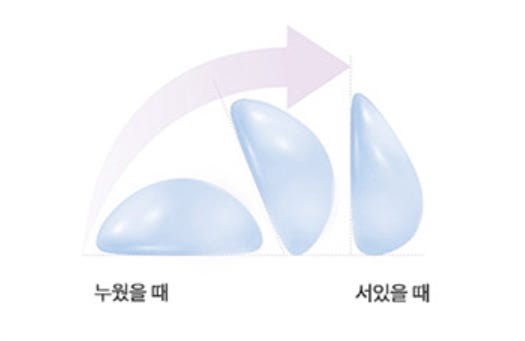 모티바가슴성형, 후기가 많으니 결과도 좋다? - 20년 경력 전문의 답변 사진 5