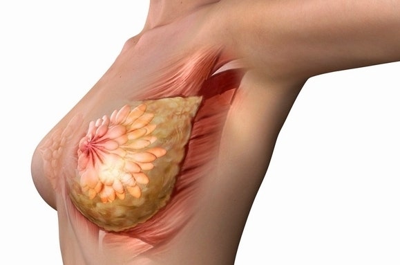 함몰유두수술병원, 콤플렉스 때문에 섣불리 받지 마세요 사진 8