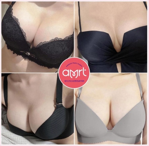 압구정가슴성형 지방이식 후 생착률 높이는 ‘이것’ 사진 8
