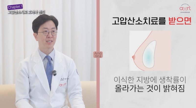 압구정가슴성형 지방이식 후 생착률 높이는 ‘이것’ 사진 11