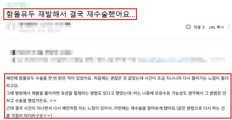 함몰유두수술후기? 10명 중 8명이 '이것' 놓치고 재발하는 이유