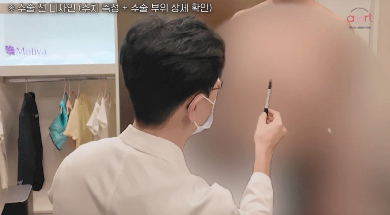가슴성형 보형물 종류 비교? 모티바 vs 멘토 vs 바운스 사진 9