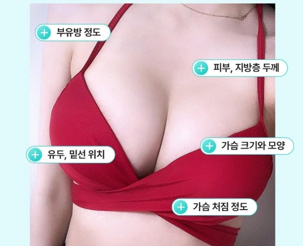 가슴성형 후 재수술, 20년 경력 의사의 조언 사진 5