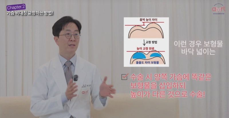 짝가슴 성형, 10명 중 9명이 하는 착각 - 20년 경력 의사 작성 사진 5