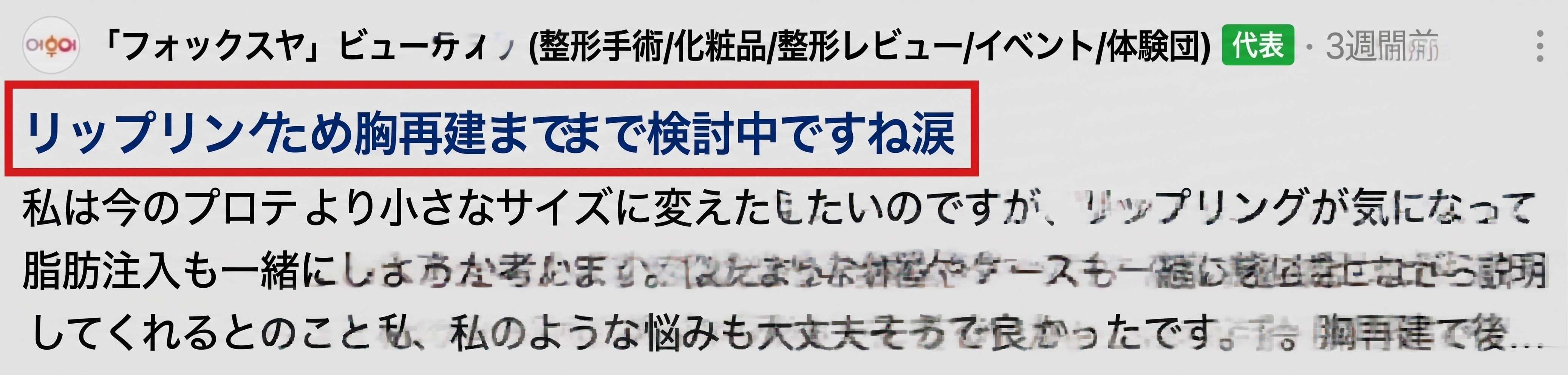 豊胸後のリップリング現象の原因とは?再手術は必ず必要?<専門医が解説> 사진 2