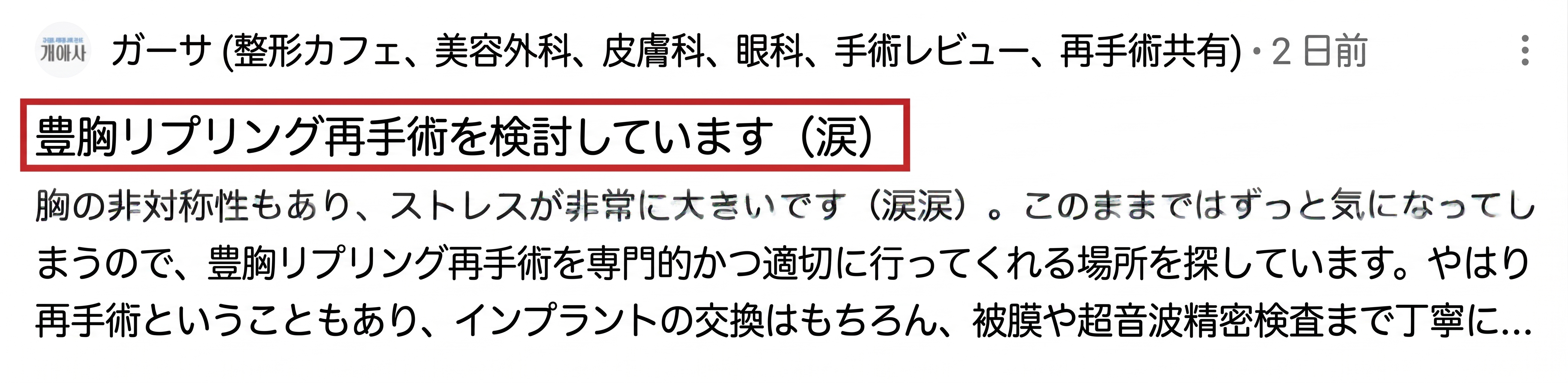 豊胸後のリップリング現象の原因とは?再手術は必ず必要?<専門医が解説> 사진 4
