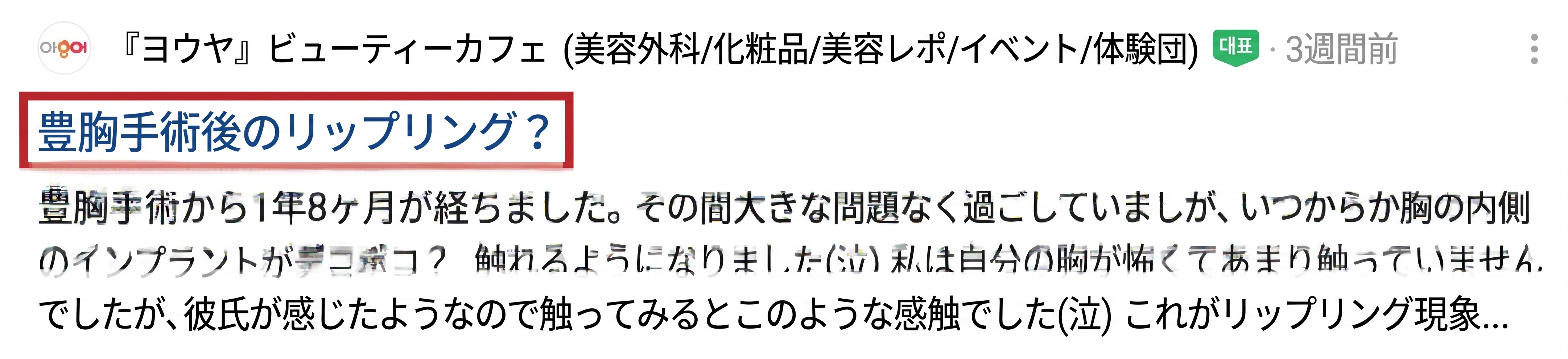 豊胸後のリップリング現象の原因とは?再手術は必ず必要?<専門医が解説> 사진 3