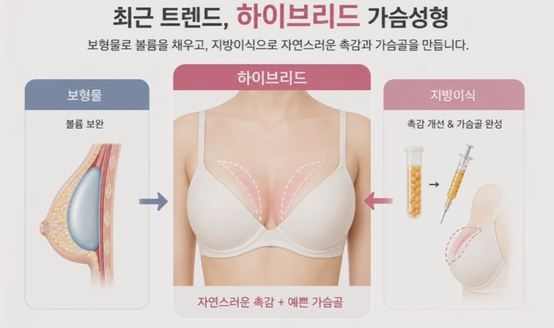 가슴 수술 보형물? 지방이식? 올바른 선택 기준 사진 9