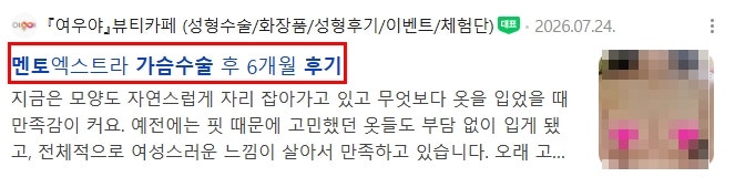 멘토가슴성형 후기 볼 때 10명 중 8명이 놓치는 기준 2가지 사진 4