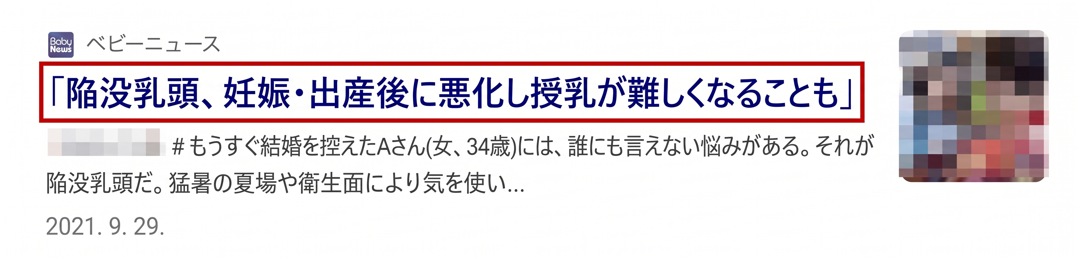 女性の陥没乳頭手術、最も多く寄せられる質問3つ〈Q&A〉 사진 3