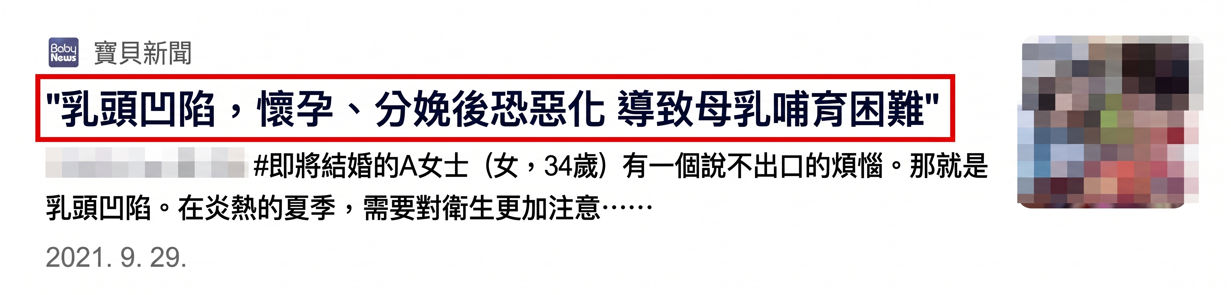 女性乳頭內陷手術，最常見的3大疑問 사진 3