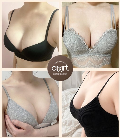 가슴확대수술 가격, 이벤트 금액이 상담 후 달라지는 이유? 사진 3