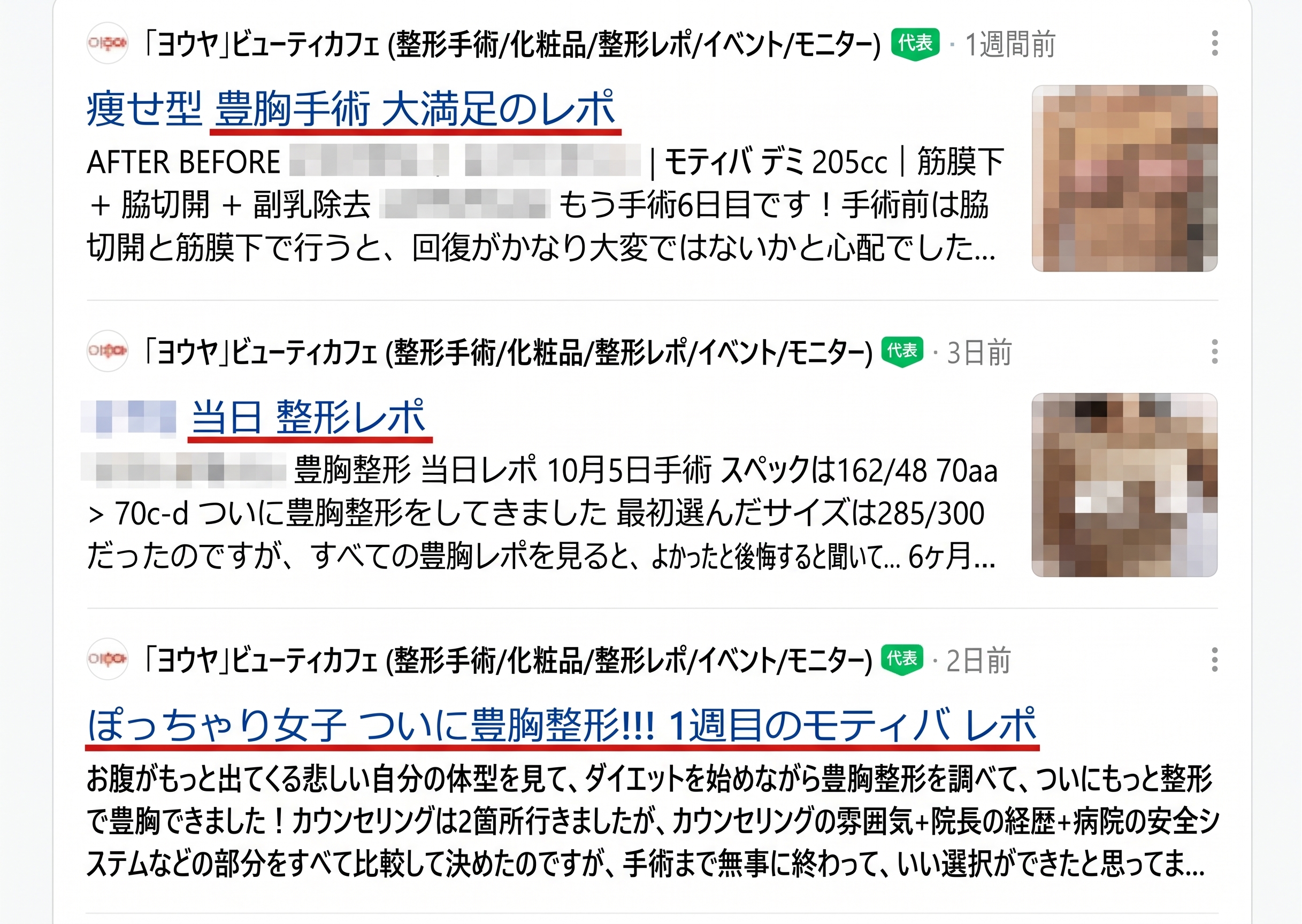 ソウルで豊胸手術が上手な病院は？口コミを見すぎると損をする理由