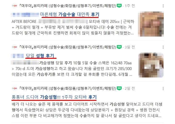 Best Breast Augmentation Clinics in Seoul? Why Reading More Reviews Can Work Against You