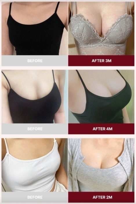 Best Breast Augmentation Clinics in Seoul? Why Reading More Reviews Can Work Against You 사진 6