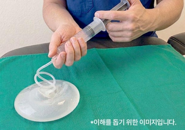 Worried About Breast Augmentation Pain and Recovery? Could Endoscopic Preserve Be the Answer? 사진 7