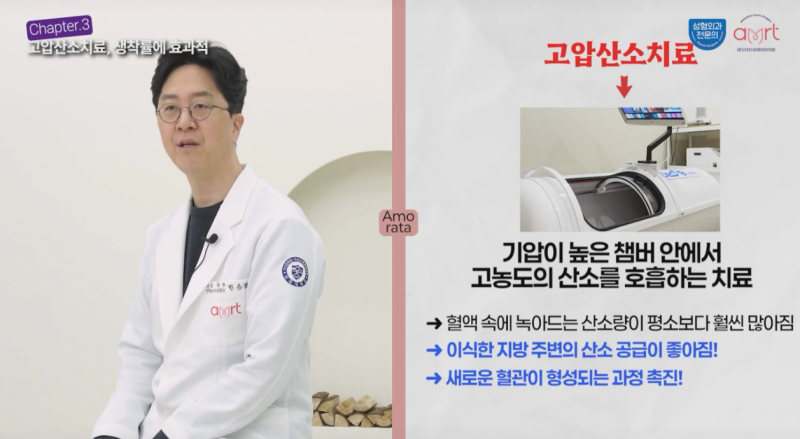 가슴지방이식후기, 생착률을 주의 깊게 봐야 하는 이유
