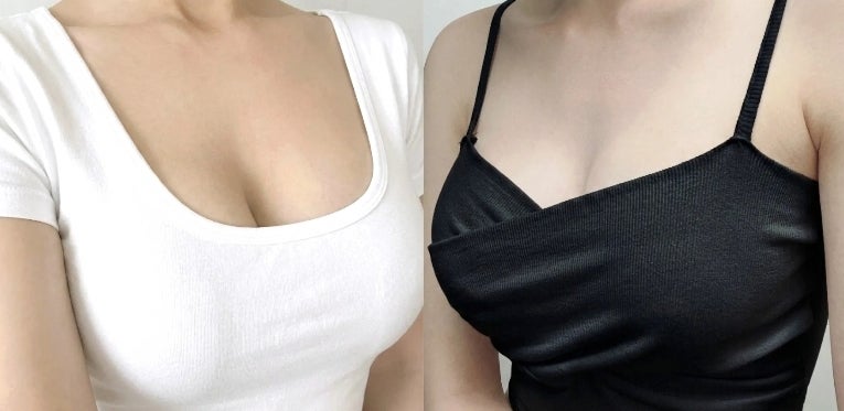 가슴 성형 나이 20대, 40대 중 언제가 적기일까? 사진 2
